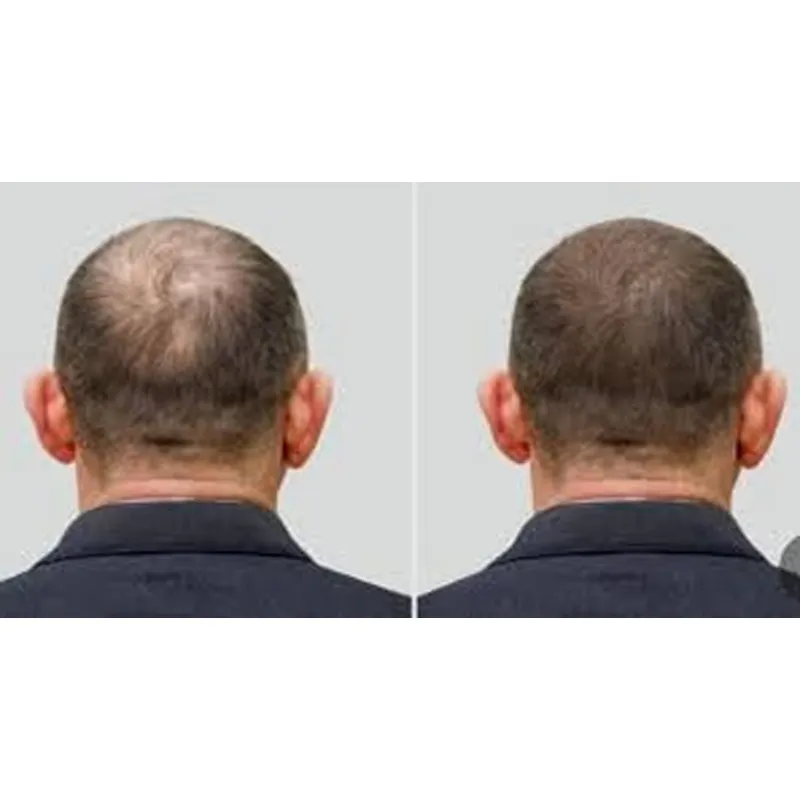 Boné de Ozônio Good Seal para  - Hair Care Good Hair avaliação e preço